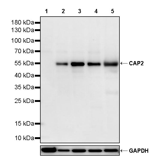 CAP2 Recombinant Rabbit mAb (S-4359-62)