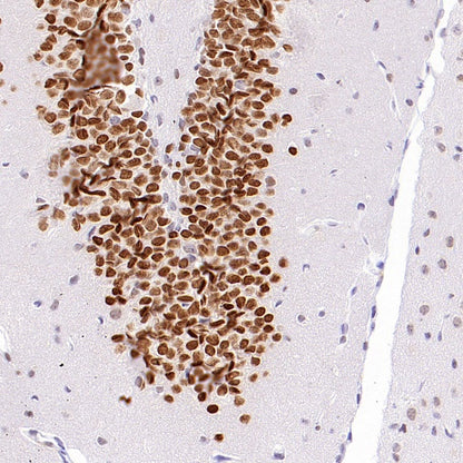 NeuroD2 Recombinant Rabbit mAb (S-3092-64)