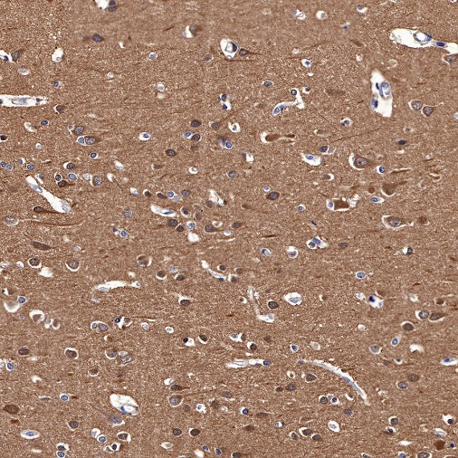 LC3B Recombinant Rabbit mAb (S-477-89)