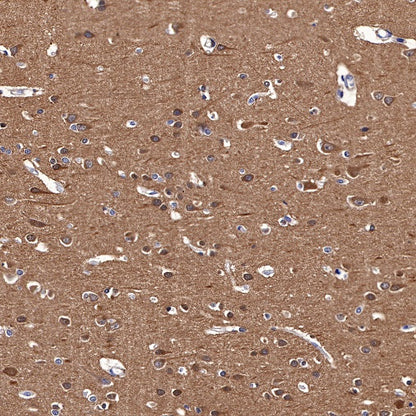 LC3B Recombinant Rabbit mAb (S-477-89)