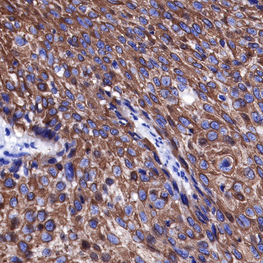 keratin 6 Rabbit mAb (SDT-015-69)