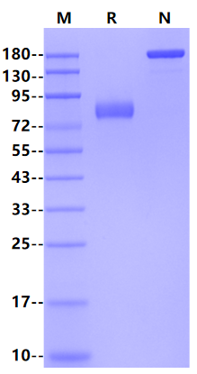 IL-18Rβ/IL-1R7 Fc Chimera Protein, Human