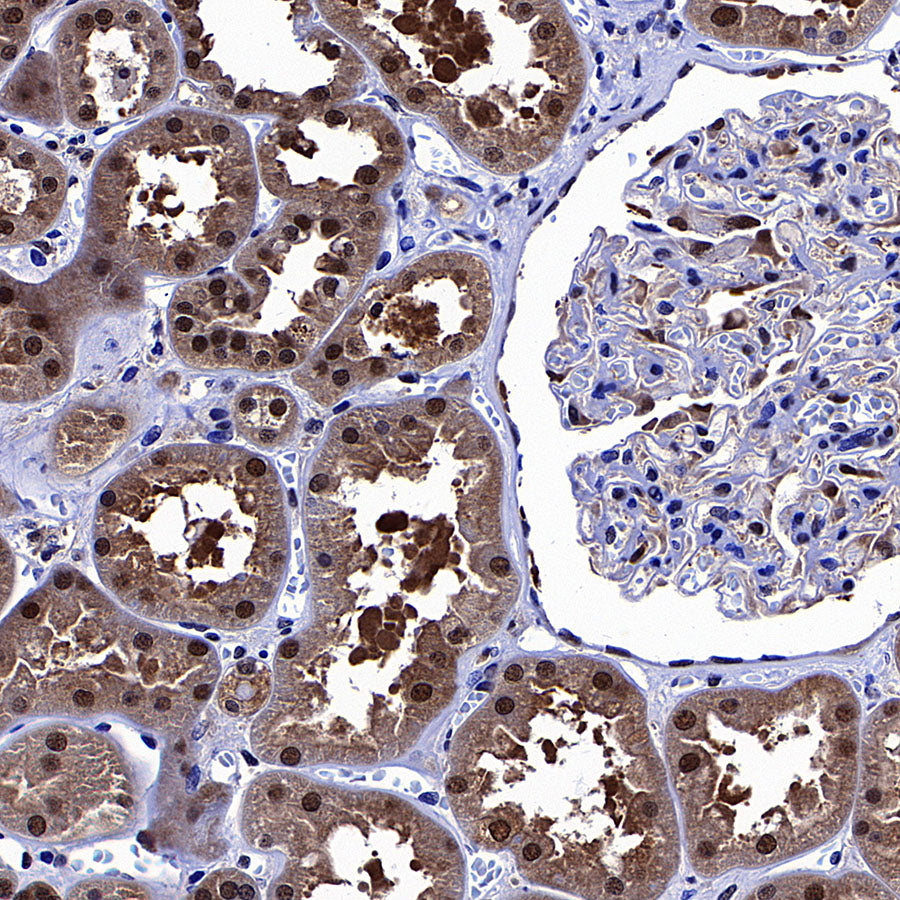 PGK1 Mouse mAb