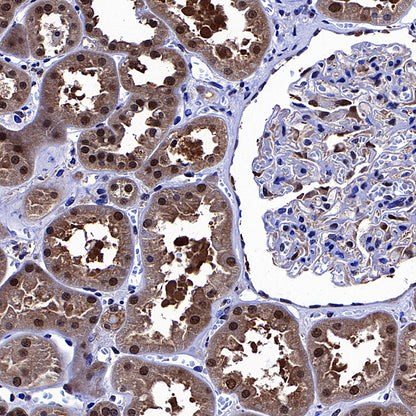 PGK1 Mouse mAb