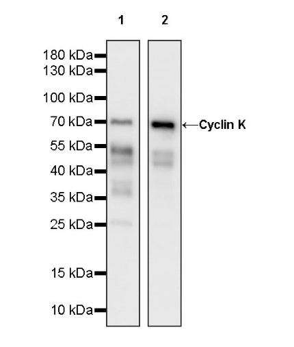 Cyclin K Recombinant Rabbit mAb (S-1586-18)