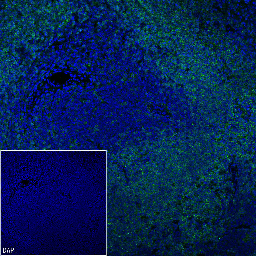 Syk Recombinant Rabbit mAb (S-4400-11)