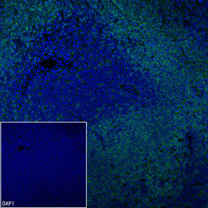 Syk Recombinant Rabbit mAb (S-4400-11)