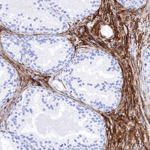 Integrin alpha 5 Recombinant Rabbit mAb (S-381-37)