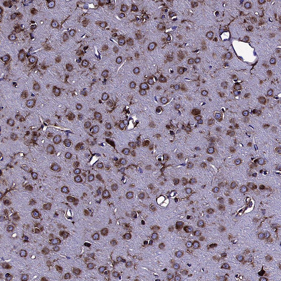 PUMA Recombinant Rabbit mAb