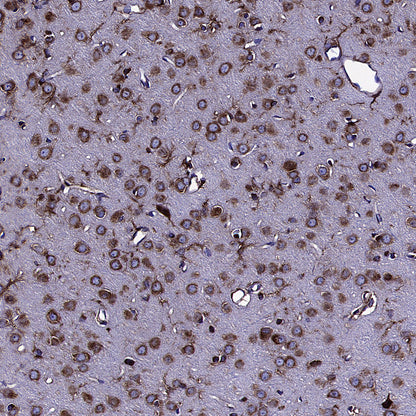 PUMA Recombinant Rabbit mAb