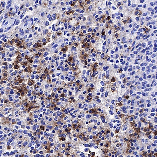 CD66a/CEACAM1 Recombinant Rabbit mAb (S-678-53)
