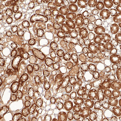 GOT2 Recombinant Rabbit mAb