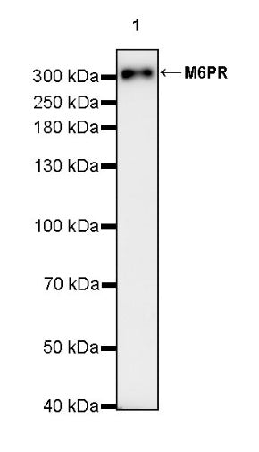 M6PR Recombinant Rabbit mAb (S-2348-14)