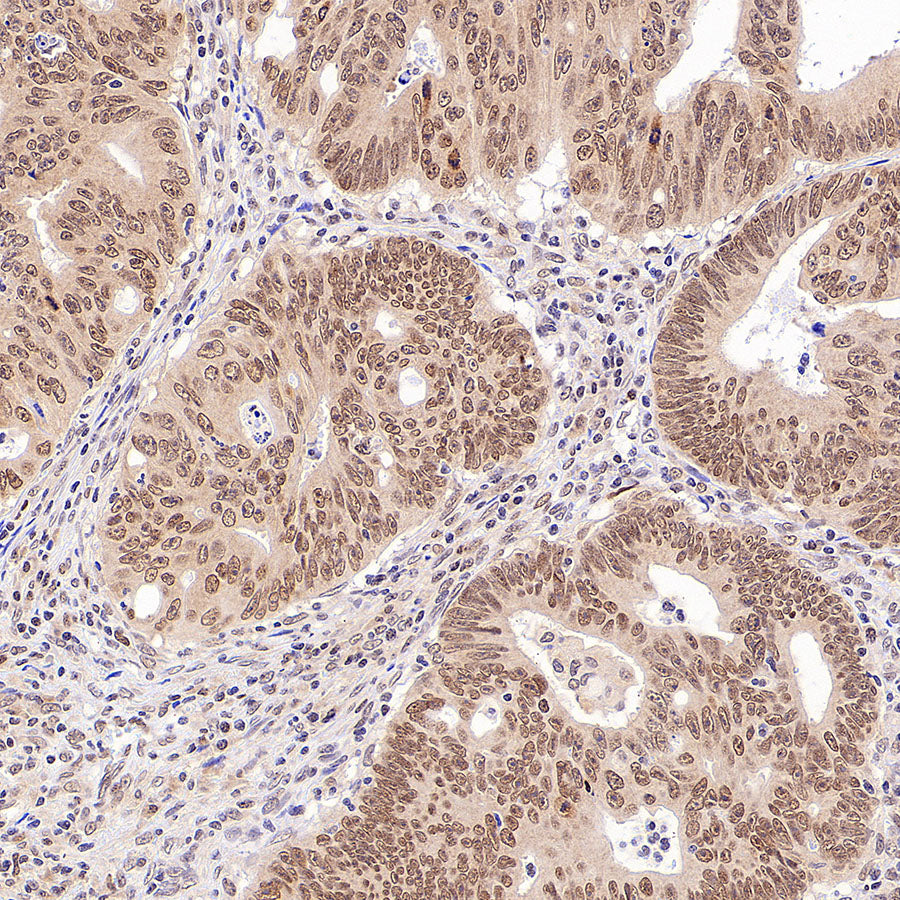 hnRNP A1 Recombinant Rabbit mAb