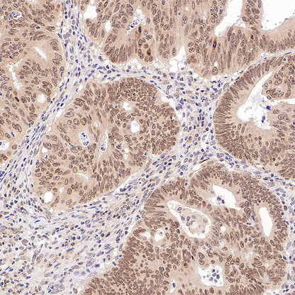 hnRNP A1 Recombinant Rabbit mAb