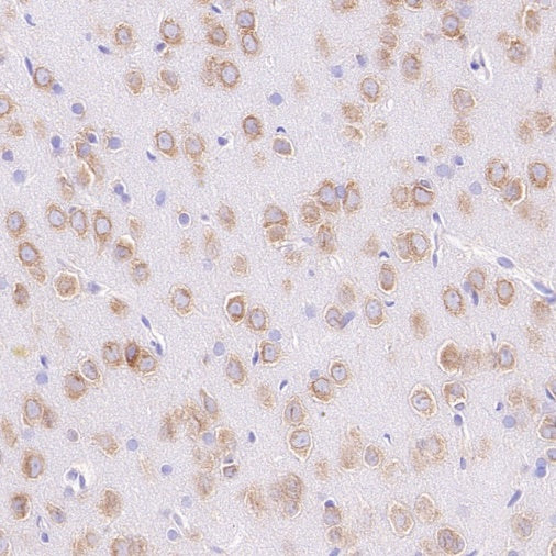 YTHDF1 Recombinant Rabbit mAb (S-3433-13)