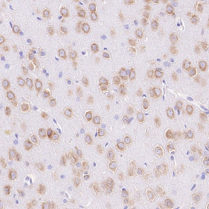 YTHDF1 Recombinant Rabbit mAb (S-3433-13)
