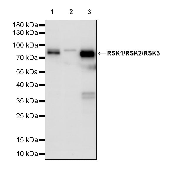 RSK1/RSK2/RSK3 Recombinant Rabbit mAb (S-4982)