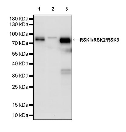 RSK1/RSK2/RSK3 Recombinant Rabbit mAb (S-4982)