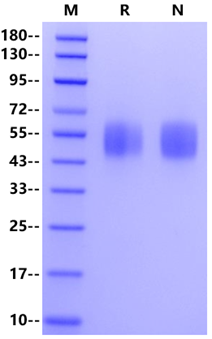 GM-CSFR α His Tag Protein, Mouse