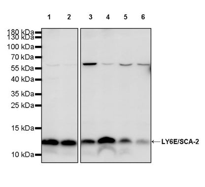 LY6E/SCA-2 Recombinant Rabbit mAb (S-2681-56)
