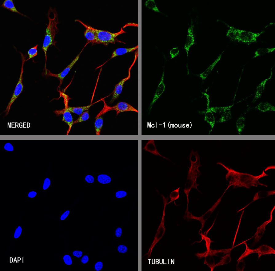 Mcl-1 Recombinant Rabbit mAb (S-3887-64)