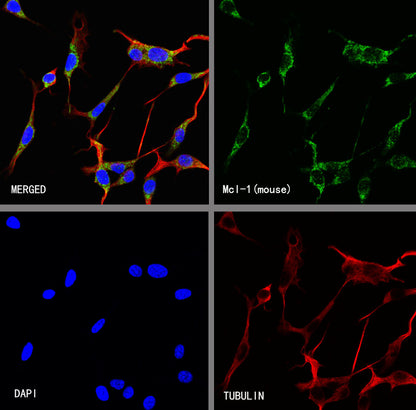 Mcl-1 Recombinant Rabbit mAb (S-3887-64)