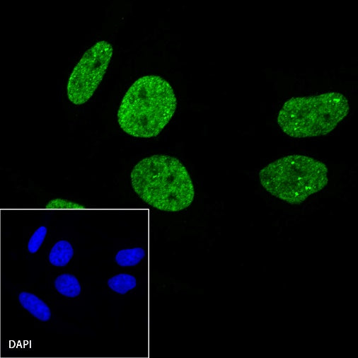 Histone H3 (mono methyl K36) Recombinant Rabbit mAb (S-R211)