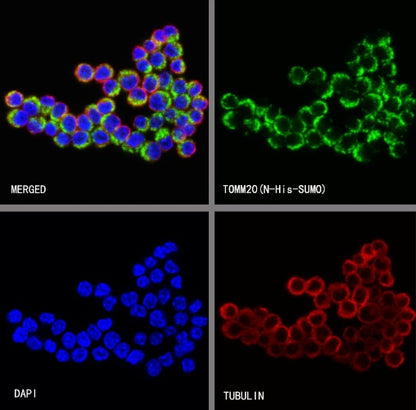 TOM20 Recombinant Rabbit mAb (SDT-2553-11)