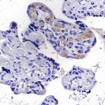 C1q Recombinant Rat mAb (S-R189)