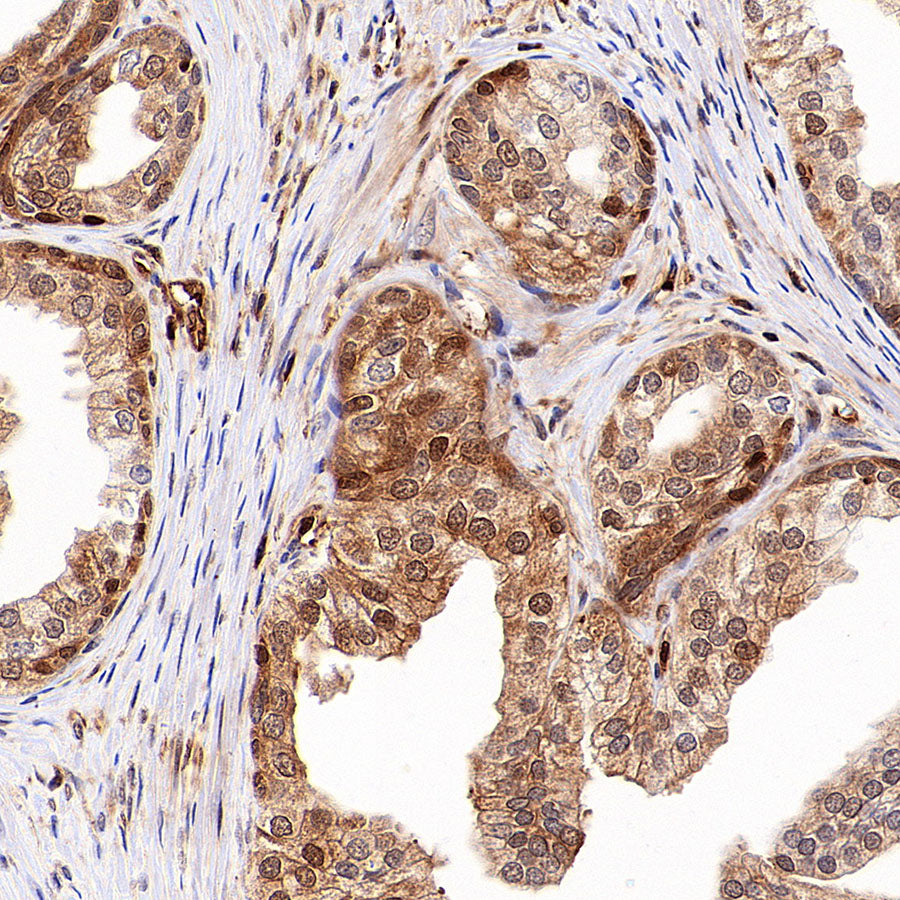 PSMB9 Recombinant Rabbit mAb (S-4183-122)
