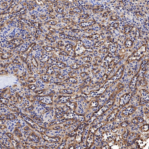 HLA-E Recombinant Rabbit mAb (S-1081-62)