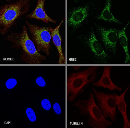 GNB2 Recombinant Rabbit mAb (S-645-10)