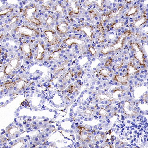 MYO7A Recombinant Rabbit mAb (S-2284-21)