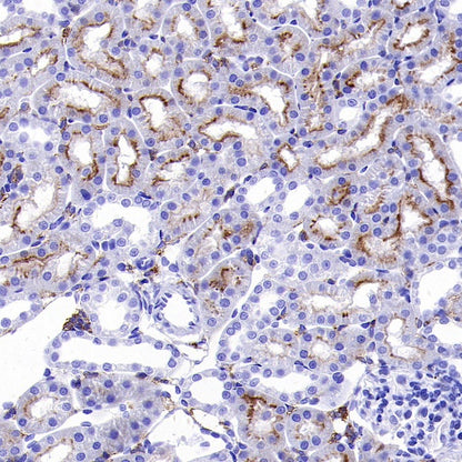 MYO7A Recombinant Rabbit mAb (S-2284-21)