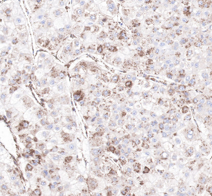 LDL receptor Recombinant Rabbit  mAb (SDT-057-57)