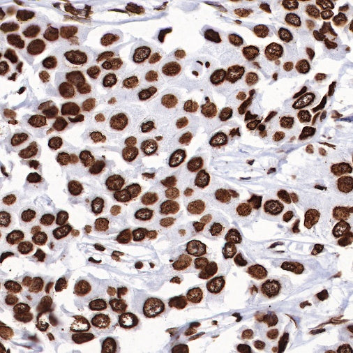 Histone H3 (tri methyl K27) Recombinant Rabbit mAb (SDT-431-118)