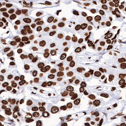 Histone H3 (tri methyl K27) Recombinant Rabbit mAb (SDT-431-118)