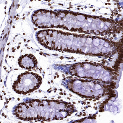Histone H3 (mono methyl K36) Recombinant Rabbit mAb (S-859-505)