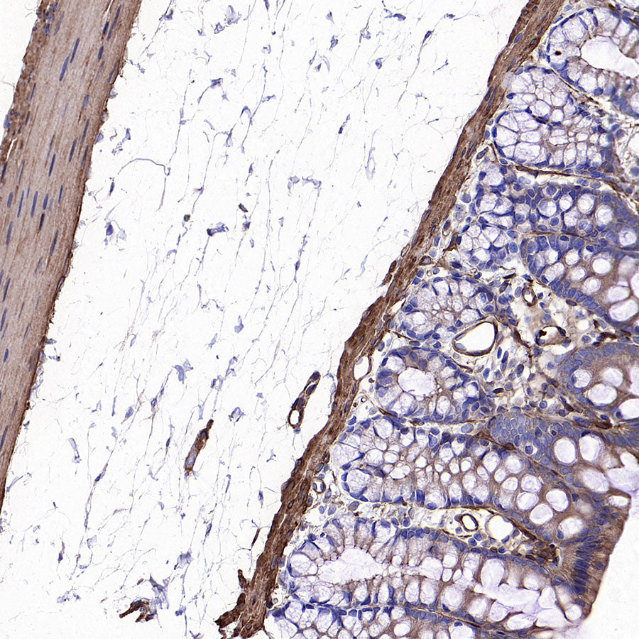 Vinculin Recombinant Rabbit mAb (S-5405)