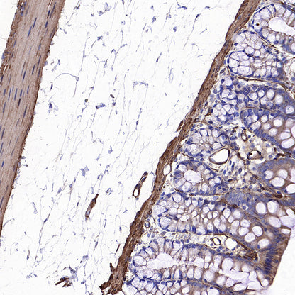 Vinculin Recombinant Rabbit mAb (S-5405)