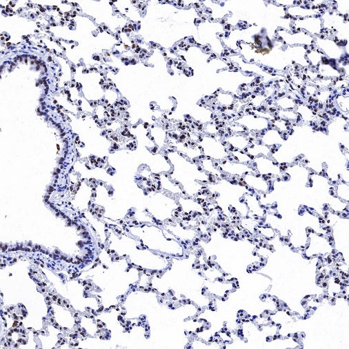 Histone H3 (di methyl K14) Recombinant Rabbit mAb (S-R414)