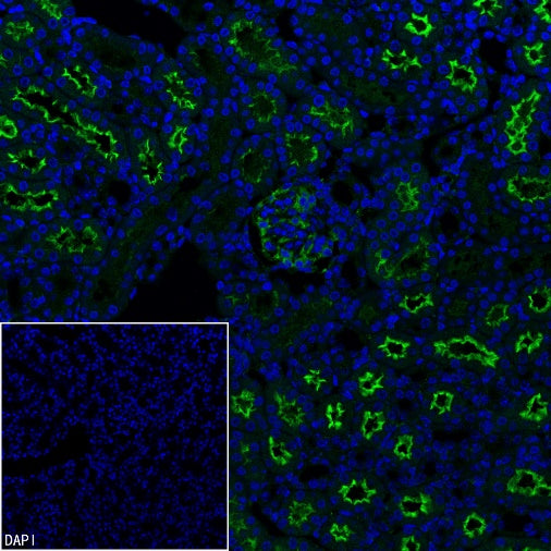 Angiotensin Converting Enzyme 1 Recombinant Rabbit mAb (SDT-2662-122)