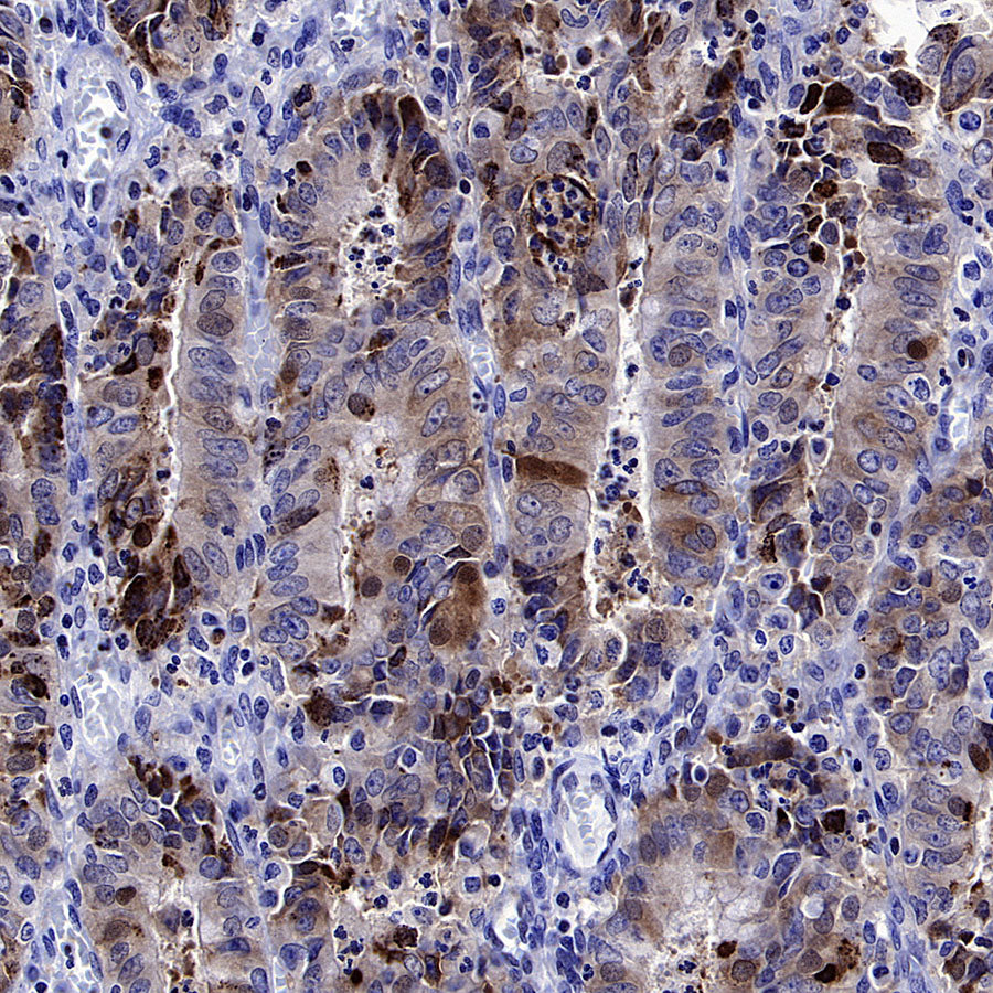 YTHDC2 Recombinant Rabbit mAb (S-3338-41)