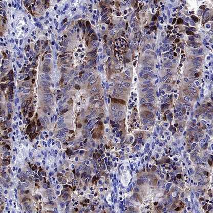 YTHDC2 Recombinant Rabbit mAb (S-3338-41)