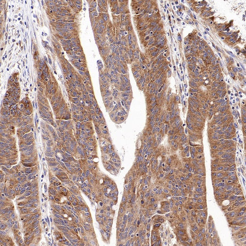 G3BP1 Rabbit Polyclonal Antibody
