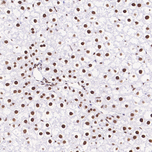 Phospho-ATF-2 (Thr71)/ATF-7 (Thr53) Recombinant Rabbit mAb (S-3535)