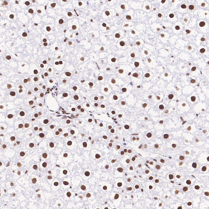 Phospho-ATF-2 (Thr71)/ATF-7 (Thr53) Recombinant Rabbit mAb (S-3535)