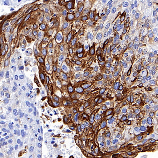 Keratin 16 Recombinant Rabbit mAb (S-R306)
