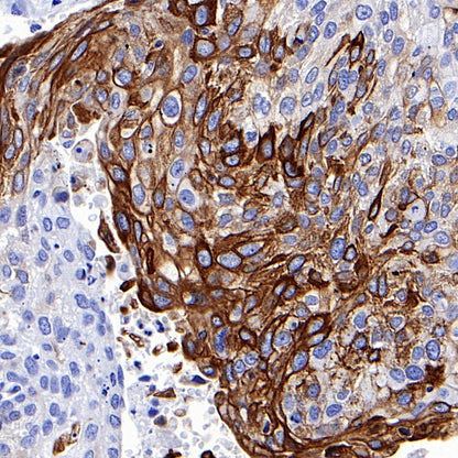 Keratin 16 Recombinant Rabbit mAb (S-R306)